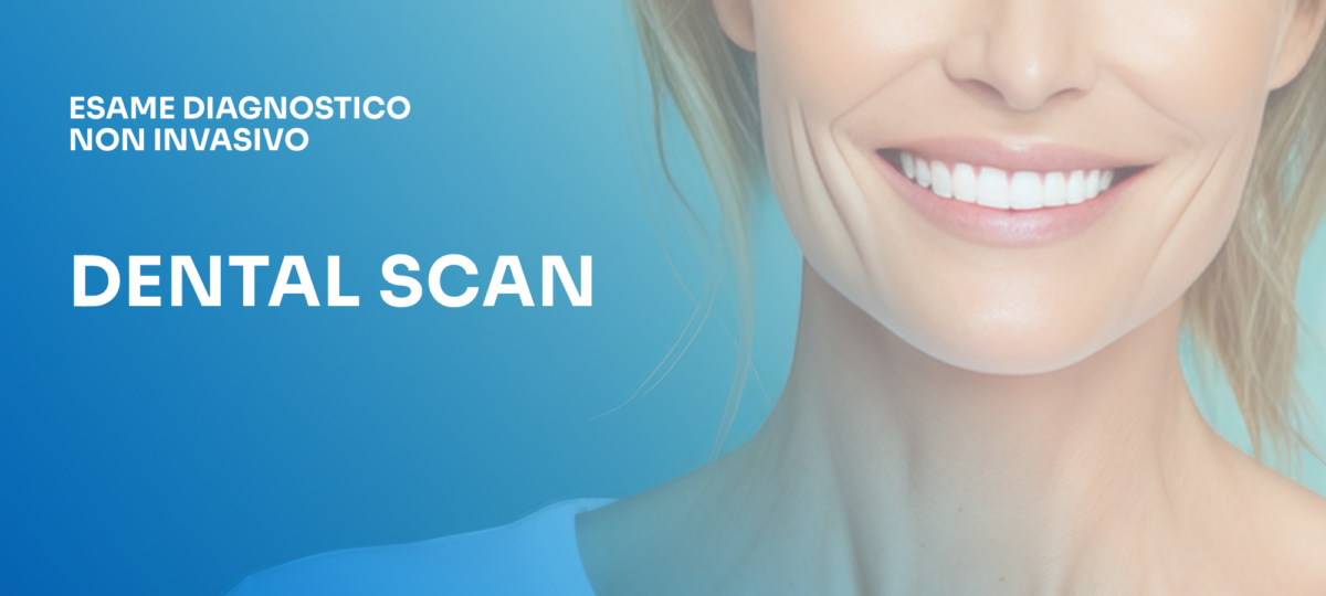 NEWS_sito_dental-scan-1200x540.png